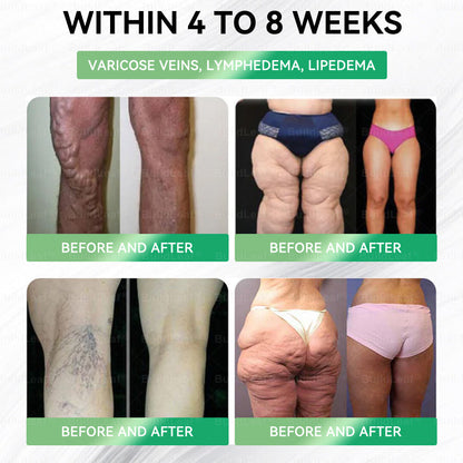 𝘽𝙪𝙞𝙡𝙙𝙇𝙚𝙖𝙛® 𝗚𝗟𝗣-𝟭 𝟐𝟎-𝗶𝗻-𝟭 𝗦𝗹𝗶𝗺 & 𝑯𝒆𝒂𝒍𝒕𝒉 𝑶𝒓𝒂𝒍 𝑺𝒐𝒍𝒖𝒕𝒊𝒐𝒏 (𝑱𝒖𝒔𝒕 𝒐𝒏𝒄𝒆 𝒂 𝒅𝒂𝒚, 𝘃𝗶𝘀𝗶𝗯𝗹𝗲 𝗰𝗵𝗮𝗻𝗴𝗲𝘀 𝗶𝗻 𝟳 𝗱𝗮𝘆𝘀 ✅ 𝘍𝘰𝘳 𝘰𝘣𝘦𝘴𝘪𝘵𝘺, 𝘤𝘢𝘳𝘥𝘪𝘰𝘷𝘢𝘴𝘤𝘶𝘭𝘢𝘳 𝘩𝘦𝘢𝘭𝘵𝘩,𝙙𝙞𝙖𝙗𝙚𝙩𝙚𝙨, 𝙨𝙡𝙚𝙚𝙥 𝐚𝐩𝐧𝐞𝐚, 𝐆𝐮𝐭 𝐇𝐞𝐚𝐥𝐭𝐡, 𝐣𝐨𝐢𝐧𝐭 𝐢𝐬𝐬𝐮𝐞𝐬, 𝐚𝐧𝐝 𝐦𝐨𝐫𝐞